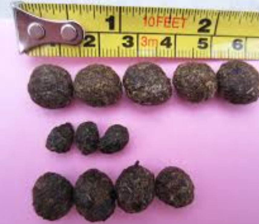 Poop Appearance - The Scoop on Your Poop's Size, Shape & Color